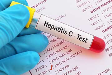 Hepatitis C test